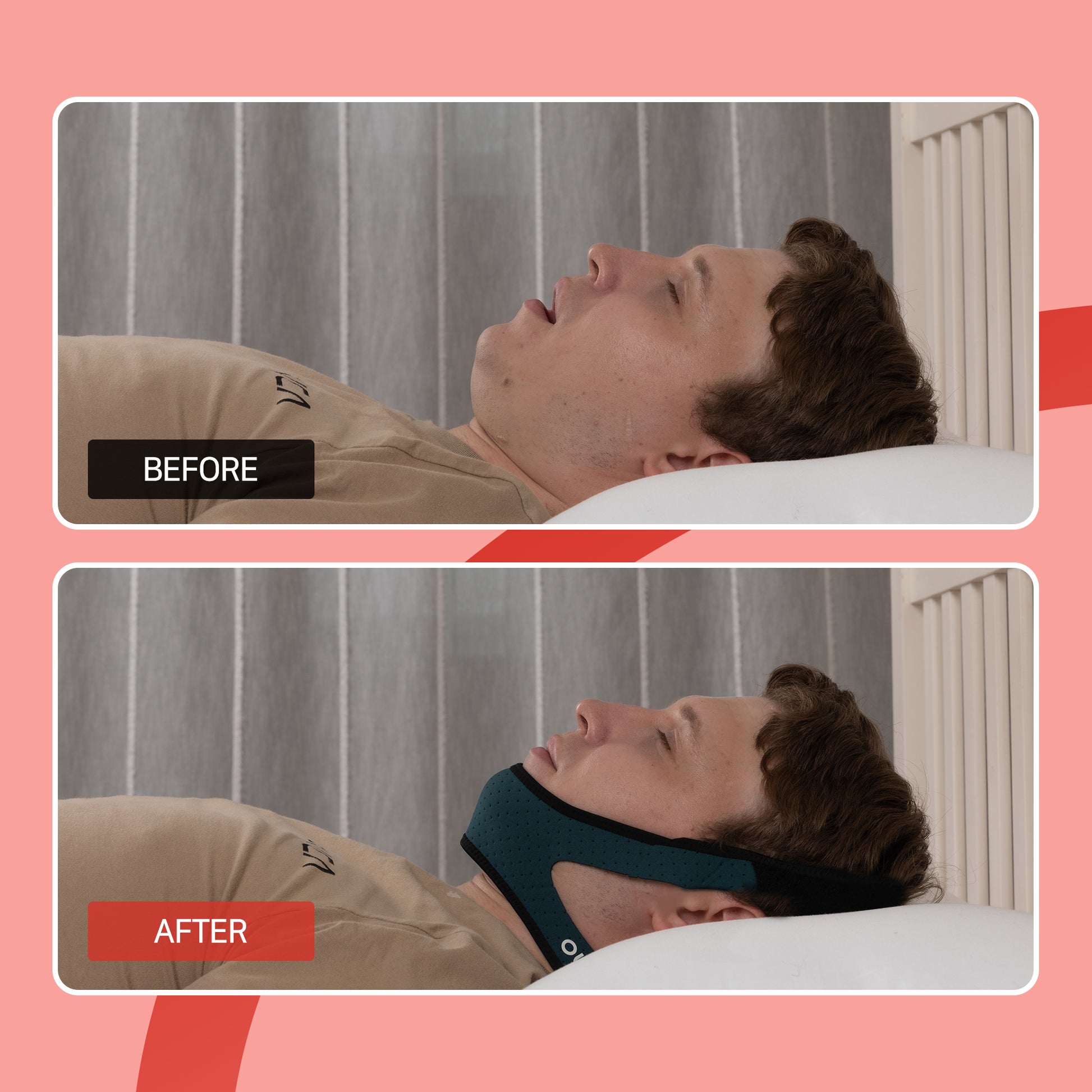 OLG Anti-Snore Chin Strap – CPAP Friendly, Breathable Mesh Support for Restful Sleep